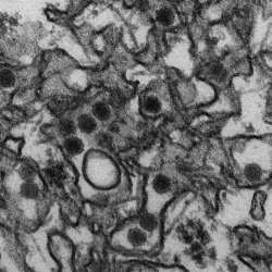 CDCによるジカウイルスの電子顕微鏡写真
